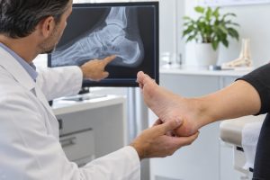 Podiatrist examining foot x-ray