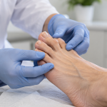 Podiatrist Determining Hammertoe