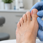 when to see a podiatrist for an ingrown toenail