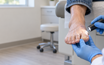 Toenail Fungus versus Trauma
